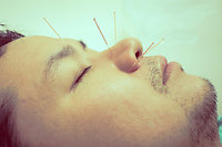 Acupuncture. Acu Man